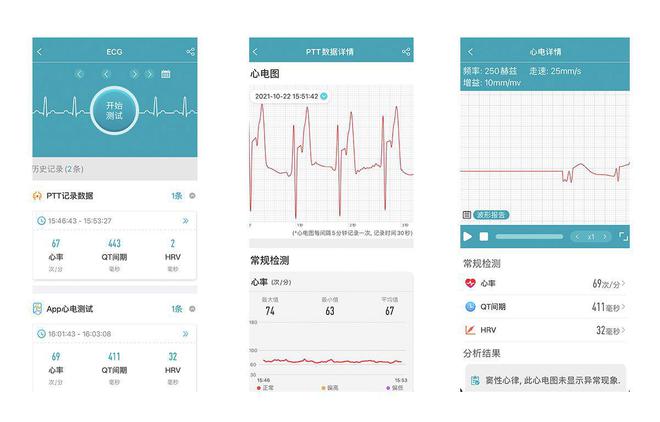 智能手環(huán)能測血壓心電？dido Y1高精度測血壓手環(huán)孝敬父母沒商量(圖9)